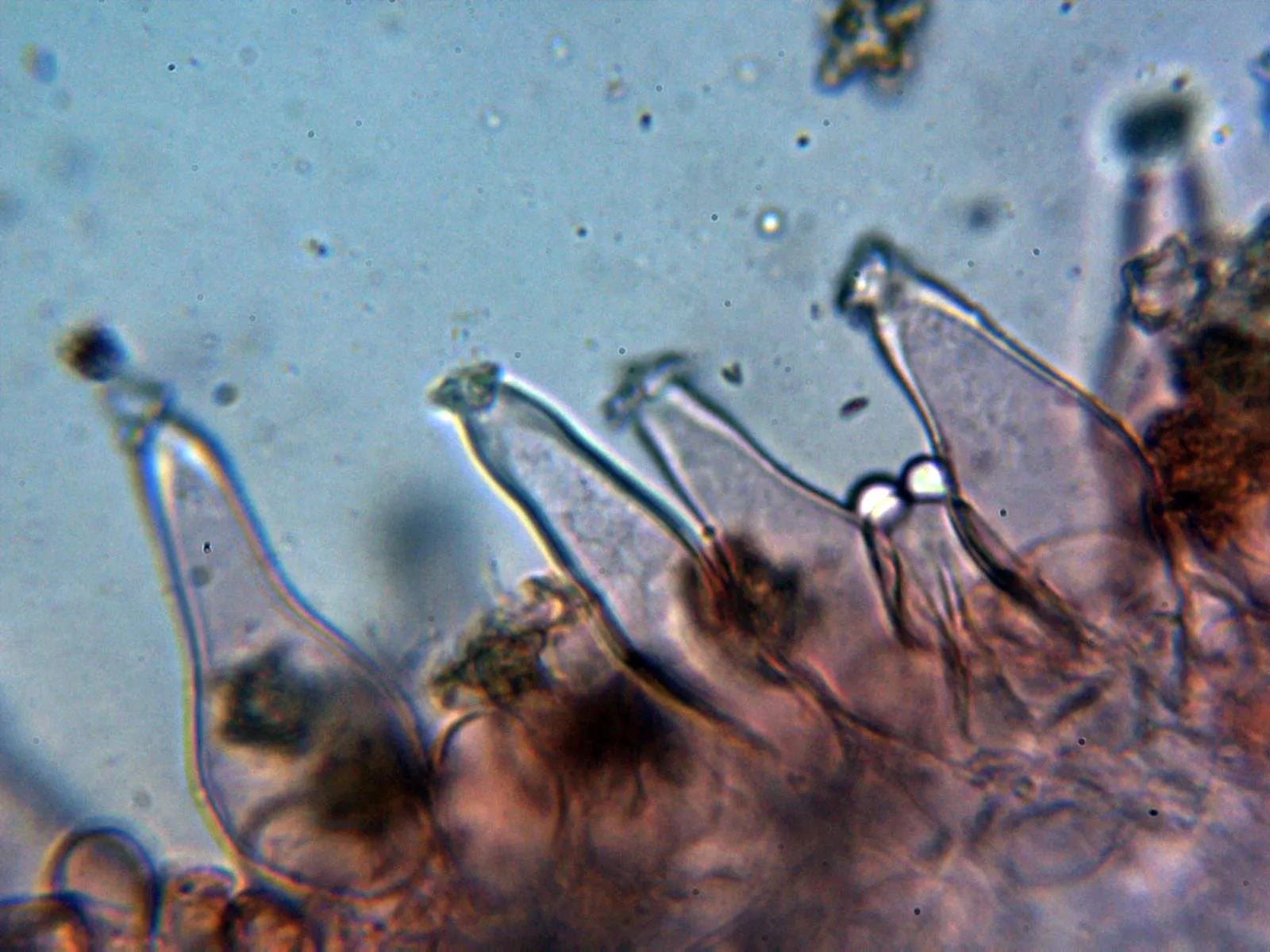 Microscopía de Inocybe asterospora - 10 - Queilocistidios 1